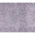 Buy Pink Animal Skin Cotton Linen 140cm